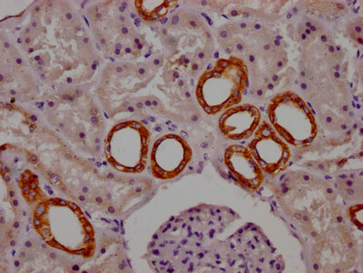 IHC image diluted at 1:100 and staining in paraffin-embedded human kidney tissue performed on a Leica BondTM system. After dewaxing and hydration, antigen retrieval was mediated by high pressure in a citrate buffer (pH 6.0). Section was blocked with 10% normal goat serum 30min at RT. Then primary antibody (1% BSA) was incubated at 4? overnight. The primary is detected by a Goat anti-rabbit IgG polymer labeled by HRP and visualized using 0.05% DAB.