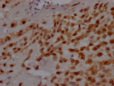 IHC image diluted at 1:100 and staining in paraffin-embedded human placenta tissue performed on a Leica BondTM system. After dewaxing and hydration, antigen retrieval was mediated by high pressure in a citrate buffer (pH 6.0). Section was blocked with 10% normal goat serum 30min at RT. Then primary antibody (1% BSA) was incubated at 4? overnight. The primary is detected by a Goat anti-rabbit IgG polymer labeled by HRP and visualized using 0.05% DAB.