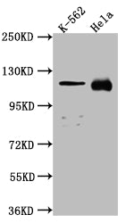 Western Blot; Positive WB detected in: K562 whole cell lysate, Hela whole cell lysate; All lanes: NUP98 antibody at 1:1000; Secondary; Goat polyclonal to rabbit IgG at 1/50000 dilution; Predicted band size: 198, 188, 98, 97, 196, 187 kDa; Observed band size: 100 kDa;