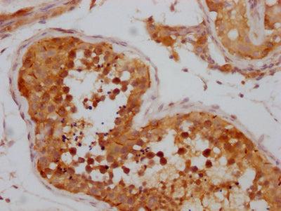 IHC image diluted at 1:100 and staining in paraffin-embedded human testis tissue performed on a Leica BondTM system. After dewaxing and hydration, antigen retrieval was mediated by high pressure in a citrate buffer (pH 6.0). Section was blocked with 10% normal goat serum 30min at RT. Then primary antibody (1% BSA) was incubated at 4? overnight. The primary is detected by a Goat anti-rabbit IgG polymer labeled by HRP and visualized using 0.05% DAB.