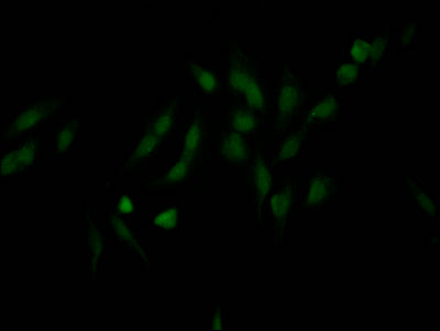 Immunofluorescence staining of Hela Cells with RAC07033 at 1:50, counter-stained with DAPI. The cells were fixed in 4% formaldehyde, permeated by 0.2% TritonX-100, and blocked in 10% normal Goat Serum. The cells were then incubated with the antibody overnight at 4?. Nuclear DNA was labeled in blue with DAPI. The secondary antibody was FITC-conjugated AffiniPure Goat Anti-Rabbit IgG (H+L).
