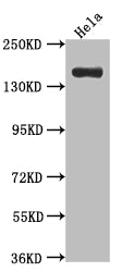 Western Blot; Positive WB detected in: Hela whole cell lysate; All lanes: Xanthine Oxidase antibody at 1:1000; Secondary; Goat polyclonal to rabbit IgG at 1/50000 dilution; Predicted band size: 147 kDa; Observed band size: 147 kDa;