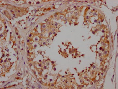 IHC image diluted at 1:100 and staining in paraffin-embedded human testis tissue performed on a Leica BondTM system. After dewaxing and hydration, antigen retrieval was mediated by high pressure in a citrate buffer (pH 6.0). Section was blocked with 10% normal goat serum 30min at RT. Then primary antibody (1% BSA) was incubated at 4? overnight. The primary is detected by a Goat anti-rabbit IgG polymer labeled by HRP and visualized using 0.05% DAB.