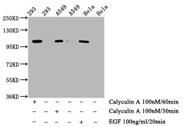 Western Blot; Positive WB detected in: 293 whole cell lysate, A549 whole cell lysate, Hela whole cell lysate (treated with Calyculin A or EGF); All lanes: Phospho-ERN1 antibody at 0.75Âµg/ml; Secondary; Goat polyclonal to rabbit IgG at 1/50000 dilution; Predicted band size: 110 kDa; Observed band size: 110 kDa