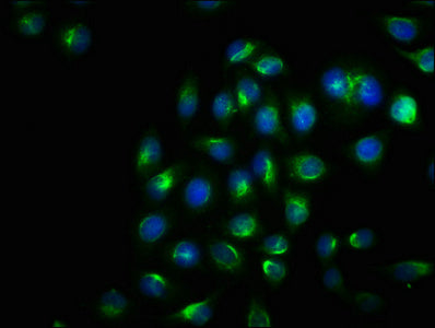 Immunofluorescence staining of Hela cells with RAC07037 at 1:100, counter-stained with DAPI. The cells were fixed in 4% formaldehyde, permeabilized using 0.2% Triton X-100 and blocked in 10% normal Goat Serum. The cells were then incubated with the antibody overnight at 4Â°C. The secondary antibody was Alexa Fluor 488-congugated AffiniPure Goat Anti-Rabbit IgG(H+L).