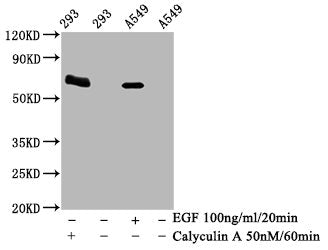 Western Blot; Positive WB detected in 293 whole cell lysate 549 whole cell lysate(treated with Calyculin A or EGF); All lanes Phospho-PRKAA2 antibody at 1.95Âµg/ml; Secondary; Goat polyclonal to rabbit IgG at 1/50000 dilution; Predicted band size: 62 KDa; Observed band size: 62 KDa;