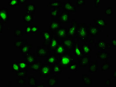 Immunofluorescence staining of A549 cells at 1:100,counter-stained with DAPI. The cells were fixed in 4% formaldehyde, permeabilized using 0.2% Triton X-100 and blocked in 10% normal Goat Serum. The cells were then incubated with the antibody overnight at 4?. The secondary antibody was Alexa Fluor 488-congugated AffiniPure Goat Anti-Rabbit IgG (H+L).
