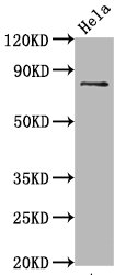 Western Blot; Positive WB detected in Hela whole cell lysate; All lanes Phospho-MAPT antibody at 0.67Âµg/ml; Secondary; Goat polyclonal to rabbit IgG at 1/50000 dilution; Predicted band size: 80 KDa; Observed band size: 80 KDa;
