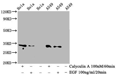 Western Blot; Positive WB detected in Hela whole cell lysate,A549 whole cell lysate(treated with Calyculin A or EGF); All lanes Phospho-CDK1/CDK2/CDK3 antibody at 0.76Âµg/ml; Secondary; Goat polyclonal to rabbit IgG at 1/50000 dilution; Predicted band size: 34 KDa; Observed band size: 34 KDa;