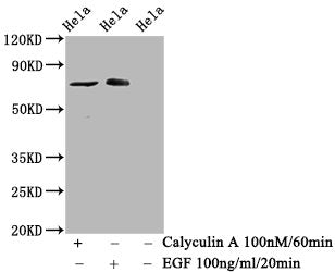 Western Blot; Positive WB detected in Hela whole cell lysate(treated with Calyculin A or EGF); All lanes Phospho-RAF1 antibody at 1.525Âµg/ml; Secondary; Goat polyclonal to rabbit IgG at 1/50000 dilution; Predicted band size: 73 KDa; Observed band size: 73 KDa;