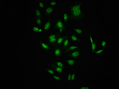 Immunofluorescence staining of HepG2 cells(treated with 50mM Calyculin A for 30min) with RAC07041 at 1:100,counter-stained with DAPI. The cells were fixed in 4% formaldehyde, permeabilized using 0.2% Triton X-100 and blocked in 10% normal Goat Serum. The cells were then incubated with the antibody overnight at 4?. The secondary antibody was Alexa Fluor 488-congugated AffiniPure Goat Anti-Rabbit IgG (H+L).