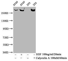 Western Blot; Positive WB detected in A549 whole cell lysate,293 whole cell lysate(treated with Calyculin A or EGF); All lanes Phospho-MTOR antibody at 1.33Âµg/ml; Secondary; Goat polyclonal to rabbit IgG at 1/50000 dilution; Predicted band size: 289 KDa; Observed band size: 289 KDa;