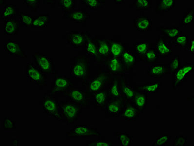 Immunofluorescence staining of Hela cells with RAC07042 at 1:100,counter-stained with DAPI. The cells were fixed in 4% formaldehyde, permeabilized using 0.2% Triton X-100 and blocked in 10% normal Goat Serum. The cells were then incubated with the antibody overnight at 4?. The secondary antibody was Alexa Fluor 488-congugated AffiniPure Goat Anti-Rabbit IgG (H+L).
