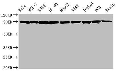 Western Blot; Positive WB detected in: Hela whole cell lysate, MCF-7 whole cell lysate, K562 whole cell lysate, HL-60 whole cell lysate, HepG2 whole cell lysate, A549 whole cell lysate, Jurkat whole cell lysate, PC3 whole cell lysate, Rat brain tissue; All lanes: Hsp90 alpha + beta antibody at 1.25Âµg/ml; Secondary; Goat polyclonal to rabbit IgG at 1/50000 dilution; Predicted band size: 90 KDa; Observed band size: 90 KDa;