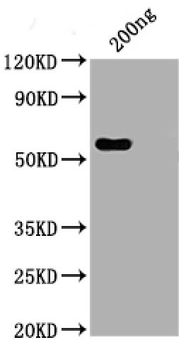 Western Blot; Positive WB detected in: His tag-tagged SARS-CoV-2 nucleocapsid recombinant protein from E. Coli ; SARS-CoV-2 nucleocapsid antibody at 1:1000 (RAC07048); Secondary; Peroxidase-Affinipure Goat Anti-Human IgG Fc? Fragment Specific at 1/20000 dilution; Predicted band size: 48 kDa; Observed band size: 55 kDa;