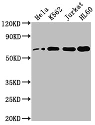 Western Blot; Positive WB detected in: Hela whole cell lysate, K562 whole cell lysate, Jurkat whole cell lysate, HL60 whole cell lysate; All lanes: HDAC1 antibody at 1:2000; Secondary; Goat polyclonal to rabbit IgG at 1/50000 dilution; Predicted band size: 56 kDa; Observed band size: 60 kDa;
