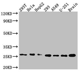 Western Blot; Positive WB detected in: 293T whole cell lysate, Hela whole cell lysate, HepG2 whole cell lysate 293 whole cell lysate, A549 whole cell lysate, U-251 whole cell lysate, Mouse Brain whole cell lysate; All lanes: Id1 antibody at 1:1000; Secondary; Goat polyclonal to rabbit IgG at 1/50000 dilution; Predicted band size: 17, 16 kDa; Observed band size: 26 kDa;