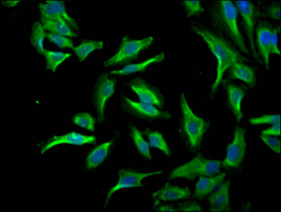 Immunofluorescence staining of Hela Cells with RAC07052 at 1:50, counter-stained with DAPI. The cells were fixed in 4% formaldehyde, permeated by 0.2% TritonX-100, and blocked in 10% normal Goat Serum. The cells were then incubated with the antibody overnight at 4?. Nuclear DNA was labeled in blue with DAPI. The secondary antibody was FITC-conjugated AffiniPure Goat Anti-Rabbit IgG (H+L).