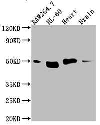 Western Blot; Positive WB detected in: RAW264.7 whole cell lysate, HL-60 whole cell lysate, Mouse Herat whole cell lysate, Mouse Brain whole cell lysate; All lanes: Tin2 antibody at 1:1000; Secondary; Goat polyclonal to rabbit IgG at 1/50000 dilution; Predicted band size: 51, 40, 16 kDa; Observed band size: 51 kDa;