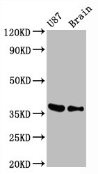 Western Blot; Positive WB detected in U87 whole cell lysate mouse brain tissue; All lanes GAPDH antibody at 0.31Âµg/ml; Secondary; Goat polyclonal to rabbit IgG at 1/50000 dilution; Predicted band size: 36 KDa; Observed band size: 36 KDa;