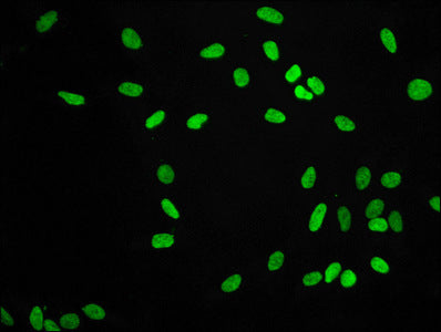 Immunofluorescence staining of Hela cells with RAC07057 at 1:56,counter-stained with DAPI. The cells were fixed in 4% formaldehyde, permeabilized using 0.2% Triton X-100 and blocked in 10% normal Goat Serum. The cells were then incubated with the antibody overnight at 4?.The secondary antibody was Alexa Fluor 488-congugated AffiniPure Goat Anti-Rabbit IgG (H+L).