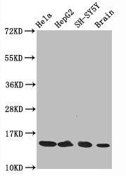 Western Blot; Positive WB detected in Hela whole cell lysate epG2 whole cell lysate H-SY5Y whole cell lysate at brain tissue; All lanes Acetyl-Histone H3.1(K14)antibody at 0.75Âµg/ml; Secondary; Goat polyclonal to rabbit IgG at 1/50000 dilution; Predicted band size: 15 KDa; Observed band size: 15 KDa;