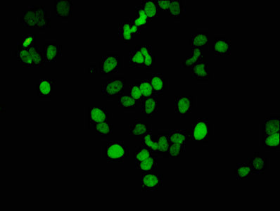 Immunofluorescence staining of Hela cells(treated by 15mM sodium butyrate for 30min) with RAC07058 at 1:46,counter-stained with DAPI. The cells were fixed in 4% formaldehyde, permeabilized using 0.2% Triton X-100 and blocked in 10% normal Goat Serum. The cells were then incubated with the antibody overnight at 4?.The secondary antibody was Alexa Fluor 488-congugated AffiniPure Goat Anti-Rabbit IgG (H+L).