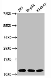 Western Blot; Positive WB detected in:293 whole cell lysate, HepG2 whole cell lysate, Mouse kidney tissue; All lanes:Acetyl-Histone H4 (K16) antibody at 1.65Âµg/ml; Secondary; Goat polyclonal to rabbit IgG at 1/50000 dilution; Predicted band size: 11 KDa; Observed band size: 11 KDa;