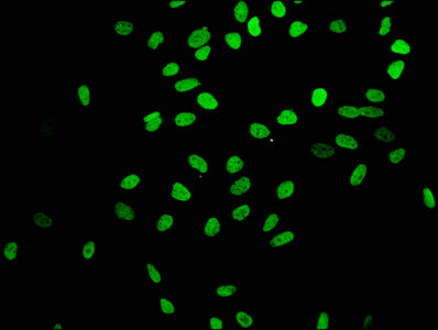 Immunofluorescence staining of Hela cells(treated by 15mM sodium butyrate for 30min) with RAC07059 at 1:403,counter-stained with DAPI. The cells were fixed in 4% formaldehyde, permeabilized using 0.2% Triton X-100 and blocked in 10% normal Goat Serum. The cells were then incubated with the antibody overnight at 4?.The secondary antibody was Alexa Fluor 488-congugated AffiniPure Goat Anti-Rabbit IgG (H+L).