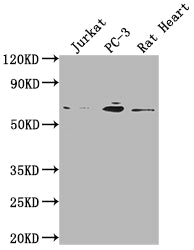 Western Blot; Positive WB detected in: Jurkat whole cell lysate, PC-3 whole cell lysate, Rat Heart tissue; All lanes: E2F1 antibody at 1:2000; Secondary; Goat polyclonal to rabbit IgG at 1/50000 dilution; Predicted band size: 47 kDa; Observed band size: 60 kDa;