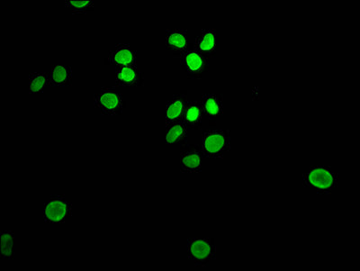 Immunofluorescence staining of Hela Cells with RAC07063 at 1:50, counter-stained with DAPI. The cells were fixed in 4% formaldehyde, permeated by 0.2% TritonX-100, and blocked in 10% normal Goat Serum. The cells were then incubated with the antibody overnight at 4?. Nuclear DNA was labeled in blue with DAPI. The secondary antibody was FITC-conjugated AffiniPure Goat Anti-Rabbit IgG (H+L).