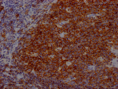 IHC image diluted at 1:100 and staining in paraffin-embedded human tonsil tissue performed on a Leica BondTM system. After dewaxing and hydration, antigen retrieval was mediated by high pressure in a citrate buffer (pH 6.0). Section was blocked with 10% normal goat serum 30min at RT. Then primary antibody (1% BSA) was incubated at 4? overnight. The primary is detected by a Goat anti-rabbit IgG polymer labeled by HRP and visualized using 0.05% DAB.