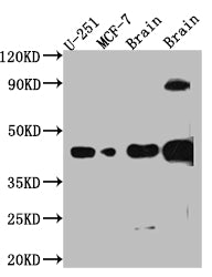 Western Blot; Positive WB detected in: U-251 whole cell lysate, MCF-7 whole cell lysate, Mouse Brain whole cell lysate, Rat Brain whole cell lysate; All lanes: SOX2 antibody at 1:1000; Secondary; Goat polyclonal to rabbit IgG at 1/50000 dilution; Predicted band size: 35 kDa; Observed band size: 40 kDa;