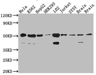Western Blot; Positive WB detected in: Hela whole cell lysate, K562 whole cell lysate, HepG2 whole cell lysate, HEK293 whole cell lysate, L02 whole cell lysate, Jurkat whole cell lysate, SH-SY5Y whole cell lysate, Mouse Brain whole cell lysate, Rat Brain cell lysate; All lanes: RbAp48 antibody at 1:1000; Secondary; Goat polyclonal to rabbit IgG at 1/50000 dilution; Predicted band size: 48, 48, 47, 44 kDa; Observed band size: 53, 40 kDa;