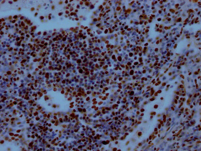 IHC image diluted at 1:100 and staining in paraffin-embedded human lung tissue performed on a Leica BondTM system. After dewaxing and hydration, antigen retrieval was mediated by high pressure in a citrate buffer (pH 6.0). Section was blocked with 10% normal goat serum 30min at RT. Then primary antibody (1% BSA) was incubated at 4? overnight. The primary is detected by a Goat anti-rabbit IgG polymer labeled by HRP and visualized using 0.05% DAB.