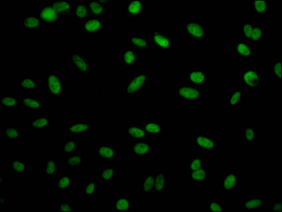 Immunofluorescence staining of Hela Cells with RAC07067 at 1:50, counter-stained with DAPI. The cells were fixed in 4% formaldehyde, permeated by 0.2% TritonX-100, and blocked in 10% normal Goat Serum. The cells were then incubated with the antibody overnight at 4?. Nuclear DNA was labeled in blue with DAPI. The secondary antibody was FITC-conjugated AffiniPure Goat Anti-Rabbit IgG (H+L).