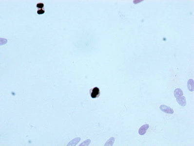 Immunocytochemistry analysis of RAC07074 diluted at 1:100 and staining in Hela cells performed on a Leica BondTM system. After dewaxing and hydration, antigen retrieval was mediated by high pressure in a citrate buffer (pH 6.0). Section was blocked with 10% normal goat serum 30min at RT. Then primary antibody (1% BSA) was incubated at 4Â°C overnight. The primary is detected by a biotinylated secondary antibody and visualized using an HRP conjugated SP system.