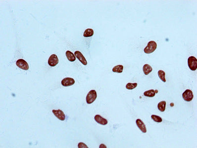 Immunocytochemistry analysis of RAC07075 diluted at 1:100 and staining in Hela cells performed on a Leica BondTM system. After dewaxing and hydration, antigen retrieval was mediated by high pressure in a citrate buffer (pH 6.0). Section was blocked with 10% normal goat serum 30min at RT. Then primary antibody (1% BSA) was incubated at 4? overnight. The primary is detected by a biotinylated secondary antibody and visualized using an HRP conjugated SP system.