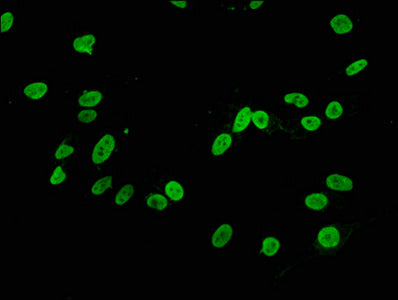 Immunofluorescence staining of Hela cells with RAC07075 at 1:34,counter-stained with DAPI. The cells were fixed in 4% formaldehyde, permeabilized using 0.2% Triton X-100 and blocked in 10% normal Goat Serum. The cells were then incubated with the antibody overnight at 4?.The secondary antibody was Alexa Fluor 488-congugated AffiniPure Goat Anti-Rabbit IgG (H+L).