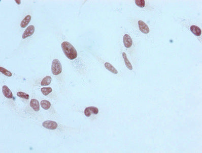 Immunocytochemistry analysis of RAC07077 diluted at 1:100 and staining in Hela cells performed on a Leica BondTM system. After dewaxing and hydration, antigen retrieval was mediated by high pressure in a citrate buffer (pH 6.0). Section was blocked with 10% normal goat serum 30min at RT. Then primary antibody (1% BSA) was incubated at 4? overnight. The primary is detected by a biotinylated secondary antibody and visualized using an HRP conjugated SP system.