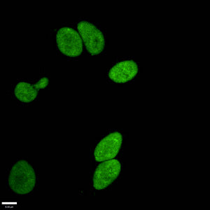 Immunofluorescence staining of Hela cells withRAC07077 at 1:96,counter-stained with DAPI. The cells were fixed in 4% formaldehyde, permeabilized using 0.2% Triton X-100 and blocked in 10% normal Goat Serum. The cells were then incubated with the antibody overnight at 4?.The secondary antibody was Alexa Fluor 488-congugated AffiniPure Goat Anti-Rabbit IgG (H+L).