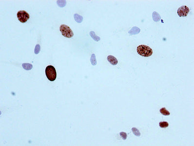 Immunocytochemistry analysis of RAC07079 diluted at 1:100 and staining in Hela cells performed on a Leica BondTM system. After dewaxing and hydration, antigen retrieval was mediated by high pressure in a citrate buffer (pH 6.0). Section was blocked with 10% normal goat serum 30min at RT. Then primary antibody (1% BSA) was incubated at 4? overnight. The primary is detected by a biotinylated secondary antibody and visualized using an HRP conjugated SP system.