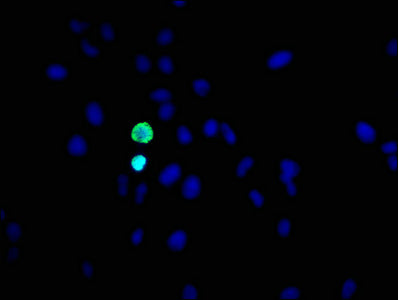 Immunofluorescence staining of Hela cells with RAC07079 at 1:31,counter-stained with DAPI. The cells were fixed in 4% formaldehyde, permeabilized using 0.2% Triton X-100 and blocked in 10% normal Goat Serum. The cells were then incubated with the antibody overnight at 4?.The secondary antibody was Alexa Fluor 488-congugated AffiniPure Goat Anti-Rabbit IgG (H+L).