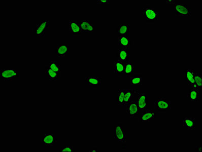 Immunofluorescence staining of Hela cells(treated by 15mM sodium butyrate for 30min) with RAC07080 at 1:65,counter-stained with DAPI. The cells were fixed in 4% formaldehyde, permeabilized using 0.2% Triton X-100 and blocked in 10% normal Goat Serum. The cells were then incubated with the antibody overnight at 4?.The secondary antibody was Alexa Fluor 488-congugated AffiniPure Goat Anti-Rabbit IgG (H+L).