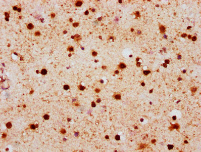 IHC image of RAC07081 diluted at 1:100 and staining in paraffin-embedded human brain tissue performed on a Leica BondTM system. After dewaxing and hydration, antigen retrieval was mediated by high pressure in a citrate buffer (pH 6.0). Section was blocked with 10% normal goat serum 30min at RT. Then primary antibody (1% BSA) was incubated at 4Â°C overnight. The primary is detected by a biotinylated secondary antibody and visualized using an HRP conjugated SP system.