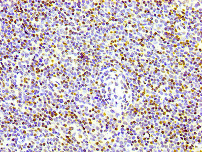IHC image of RAC07083 diluted at 1:100 and staining in paraffin-embedded human lymph node tissue performed on a Leica BondTM system. After dewaxing and hydration, antigen retrieval was mediated by high pressure in a citrate buffer (pH 6.0). Section was blocked with 10% normal goat serum 30min at RT. Then primary antibody (1% BSA) was incubated at 4? overnight. The primary is detected by a biotinylated secondary antibody and visualized using an HRP conjugated SP system.