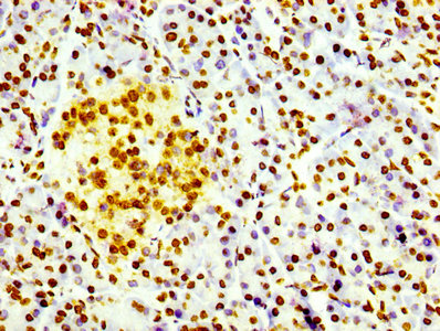 IHC image of RAC07083 diluted at 1:100 and staining in paraffin-embedded human pancreatic tissue performed on a Leica BondTM system. After dewaxing and hydration, antigen retrieval was mediated by high pressure in a citrate buffer (pH 6.0). Section was blocked with 10% normal goat serum 30min at RT. Then primary antibody (1% BSA) was incubated at 4? overnight. The primary is detected by a biotinylated secondary antibody and visualized using an HRP conjugated SP system.