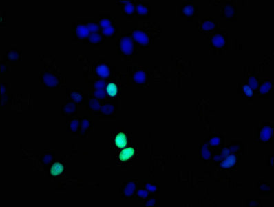 Immunofluorescence staining of MCF-7 cells with RAC07083 at 1:56,counter-stained with DAPI. The cells were fixed in 4% formaldehyde, permeabilized using 0.2% Triton X-100 and blocked in 10% normal Goat Serum. The cells were then incubated with the antibody overnight at 4?.The secondary antibody was Alexa Fluor 488-congugated AffiniPure Goat Anti-Rabbit IgG (H+L).