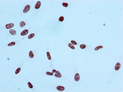 Immunocytochemistry analysis of RAC07084 diluted at 1:100 and staining in Hela cells performed on a Leica BondTM system. After dewaxing and hydration, antigen retrieval was mediated by high pressure in a citrate buffer (pH 6.0). Section was blocked with 10% normal goat serum 30min at RT. Then primary antibody (1% BSA) was incubated at 4? overnight. The primary is detected by a biotinylated secondary antibody and visualized using an HRP conjugated SP system.