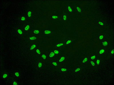 Immunofluorescence staining of Hela cells(treated by 15mM sodium butyrate for 30min) with RAC07084 at 1:56,counter-stained with DAPI. The cells were fixed in 4% formaldehyde, permeabilized using 0.2% Triton X-100 and blocked in 10% normal Goat Serum. The cells were then incubated with the antibody overnight at 4?.The secondary antibody was Alexa Fluor 488-congugated AffiniPure Goat Anti-Rabbit IgG (H+L).